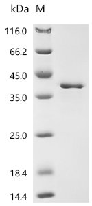 Staphylococcus aureus Large ribosomal subunit protein uL2 (rplB) Recombinant Protein, Staphylococcus aureus (strain JH1), E.coli, C-terminal 6xHis-tagged, 37.1 kDa, purity >≥ 85% as determined by SDS-PAGE.