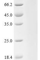 Human Fibulin-1 (FBLN1) Recombinant Protein, N-His-KSI - BioCrest Sci