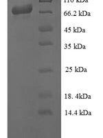 Giardia intestinalis Endoribonuclease Dicer-like (GL50803_103887) Recombinant Protein - BioCrest Sci