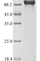 Escherichia coli Ferric aerobactin receptor (iutA) Recombinant Protein - BioCrest Sci