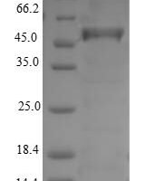 Portulaca grandiflora 4,5-DOPA dioxygenase extradiol (DODA) Recombinant Protein - BioCrest Sci