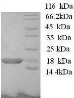 Human BolA-like protein 1 (BOLA1) Recombinant Protein - BioCrest Sci