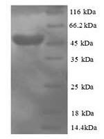Human Protein canopy homolog 2 (CNPY2) Recombinant Protein - BioCrest Sci