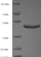 Streptomyces actuosus Nosiheptide precursor (nosM) Recombinant Protein, N-GST, aa 1–50, E.coli - BioCrest Sci