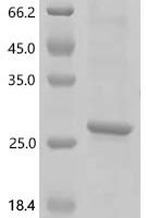 Human Neuromedin-U (NMU) Recombinant Protein - BioCrest Sci