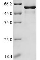 Mouse Testican-2 (Spock2) Recombinant Protein - BioCrest Sci
