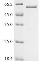 Human Actin-related protein 2/3 complex subunit 2 (ARPC2), partial Recombinant Protein, C-GST - BioCrest Sci