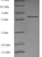 Human  Transmembrane protein 141 (TMEM141) Recombinant Protein - BioCrest Sci
