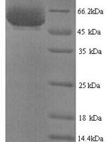 Shigella flexneri serotype X E3 ubiquitin-protein ligase ipaH9.8 (ipaH9.8) Recombinant Protein, N-His, aa 1–545, Yeast - BioCrest Sci