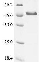 Bovine Alpha-2-HS-glycoprotein (AHSG) Recombinant Protein - BioCrest Sci