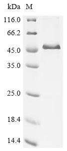 Bovine Alpha-2-HS-glycoprotein (AHSG) Recombinant Protein, Bos taurus (Bovine), E.coli, N-terminal 10xHis-tagged and C-terminal Myc-tagged, 41.4 kDa, purity >≥ 85% as determined by SDS-PAGE.