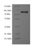Human Protein RMD5 homolog A (RMND5A) Recombinant Protein - BioCrest Sci