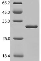 Horse Ferritin heavy chain (FTH1),  partial Recombinant Protein - BioCrest Sci