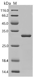 Horse Ferritin heavy chain (FTH1), partial Recombinant Protein, Equus caballus (Horse), E.coli, C-terminal 6xHis-tagged, 28.1 kDa, purity >≥ 85% as determined by SDS-PAGE.