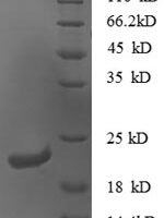Mouse C-X-C motif chemokine 16 (Cxcl16), partial Recombinant Protein - BioCrest Sci