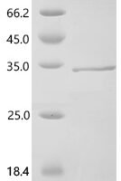 Human T-cell acute lymphocytic leukemia protein 1 (TAL1), partial Recombinant Protein, N-GST/C-His - BioCrest Sci