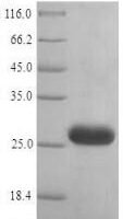 Human Histamine H1 receptor (HRH1), partial Recombinant Protein - BioCrest Sci