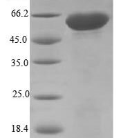 Mouse Disintegrin and metalloproteinase domain-containing protein 12 (Adam12), partial Recombinant Protein, N-10His/C-Myc, aa 206–706, E.coli - BioCrest Sci