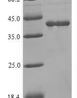 Human Lutropin-choriogonadotropic hormone receptor (LHCGR), partial Recombinant Protein, N-His, aa 27–363, Mammalian cell - BioCrest Sci