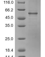 Mouse Sushi repeat-containing protein SRPX2 (Srpx2) Recombinant Protein, N-10His/C-Myc - BioCrest Sci