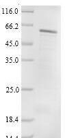 Human Protein cereblon (CRBN) Recombinant Protein, C-9xHis - BioCrest Sci