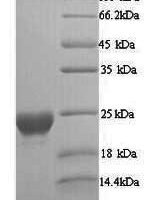 Alternaria alternata Major allergen Alt a 1 (ALTA1) Recombinant Protein - BioCrest Sci