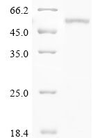 Mouse Phenylalanine-4-hydroxylase (Pah) Recombinant Protein - BioCrest Sci