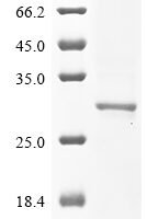 Human Ras-related protein Rab-10 (RAB10) Recombinant Protein - BioCrest Sci