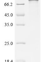 Human Sentrin-specific protease 1 (SENP1) Recombinant Protein - BioCrest Sci