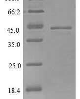 Mouse CCN family member 1 (Ccn1) Recombinant Protein, N-10His, aa 25–379, E.coli - BioCrest Sci
