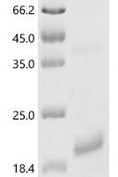 Horse Follitropin subunit beta (FSHB) Recombinant Protein - BioCrest Sci