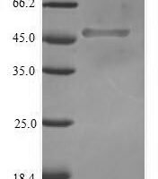 Human Transcription factor SOX-2 (SOX2) Recombinant Protein - BioCrest Sci