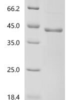Bovine Pregnancy-associated glycoprotein 1 Recombinant Protein, C-His - BioCrest Sci