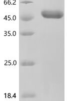 Human Cytotoxic T-lymphocyte protein 4 (CTLA4), partial Recombinant Protein, C-hFc1 - BioCrest Sci