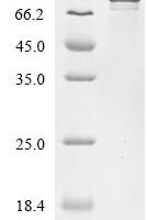 Saccharomyces cerevisiae Lipid-anchored plasma membrane protein CPP1 (CPP1) Recombinant Protein, C-10His-HSA - BioCrest Sci