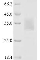 Human Stimulator of interferon genes protein (STING1), partial Recombinant Protein - BioCrest Sci