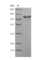 Mycoplasma pneumoniae  Putative proline iminopeptidase (pip) Recombinant Protein - BioCrest Sci