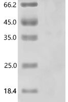 Human Cold shock domain-containing protein E1 (CSDE1) Recombinant Protein, C-His - BioCrest Sci