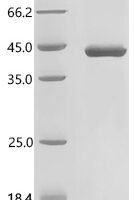 Rat Lutropin-choriogonadotropic hormone receptor (Lhcgr), partial Recombinant Protein, N-His, aa 27–362, E.coli - BioCrest Sci