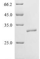 Human Neutrophil elastase (ELANE) Recombinant Protein, C-10His - BioCrest Sci