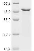 Human Transcription factor SOX-1 (SOX1) Recombinant Protein, N-10His/C-Myc - BioCrest Sci