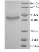 Mouse Hyaluronan synthase 2 (Has2), partial Recombinant Protein, N-His - BioCrest Sci