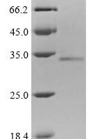Human Protein mono-ADP-ribosyltransferase PARP9 (PARP9), partial Recombinant Protein, N-10His/C-Myc, aa 628–854, Mammalian cell - BioCrest Sci