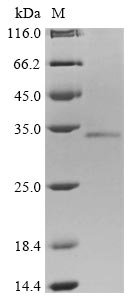 Human Protein mono-ADP-ribosyltransferase PARP9 (PARP9), partial Recombinant Protein, N-10His/C-Myc, aa 628–854, Mammalian cell, Homo sapiens (Human), Mammalian cell, N-terminal 10xHis-tagged and C-terminal Myc-tagged, 30.9 kDa, purity >≥ 85% as determined by SDS-PAGE.
