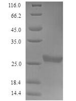Human Acetylcholine receptor subunit gamma (CHRNG), partial Recombinant Protein, N-His-tagged/Tag-Free - BioCrest Sci