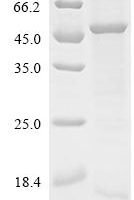 Human FBXW7&SKP1 Heterodimer Protein Recombinant Protein - BioCrest Sci