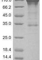 Human Mast/stem cell growth factor receptor Kit (KIT), partial Recombinant Protein - BioCrest Sci