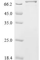Human GRB10-interacting GYF protein 2 (GIGYF2), partial Recombinant Protein, N-His, aa 510–1030, E.coli - BioCrest Sci