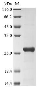 Human Eukaryotic translation initiation factor 4E (EIF4E) (S209D) Recombinant Protein, Tag-Free, Homo sapiens (Human), E.coli, Tag-Free, 25.2 kDa, purity >≥ 85% as determined by SDS-PAGE.