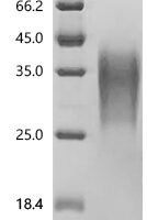 Human TGF-beta receptor type-2 (TGFBR2), partial Recombinant Protein - BioCrest Sci